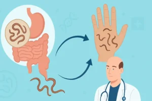 How Worm Infections Spread: Understanding Worm Transmission